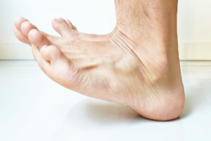 Heel and Toe Dips to Improve Lower Leg Circulation