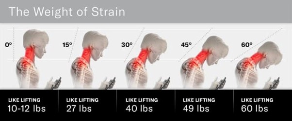 tech-neck-diagram